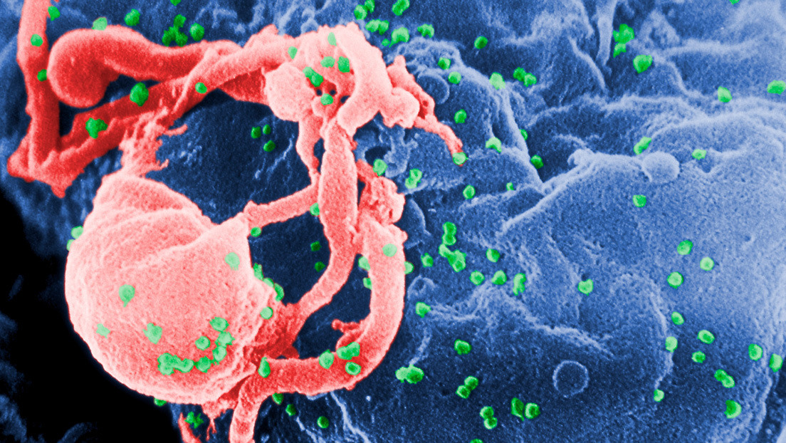 Una mujer de California podría ser la primera en curarse de VIH sin medicamentos